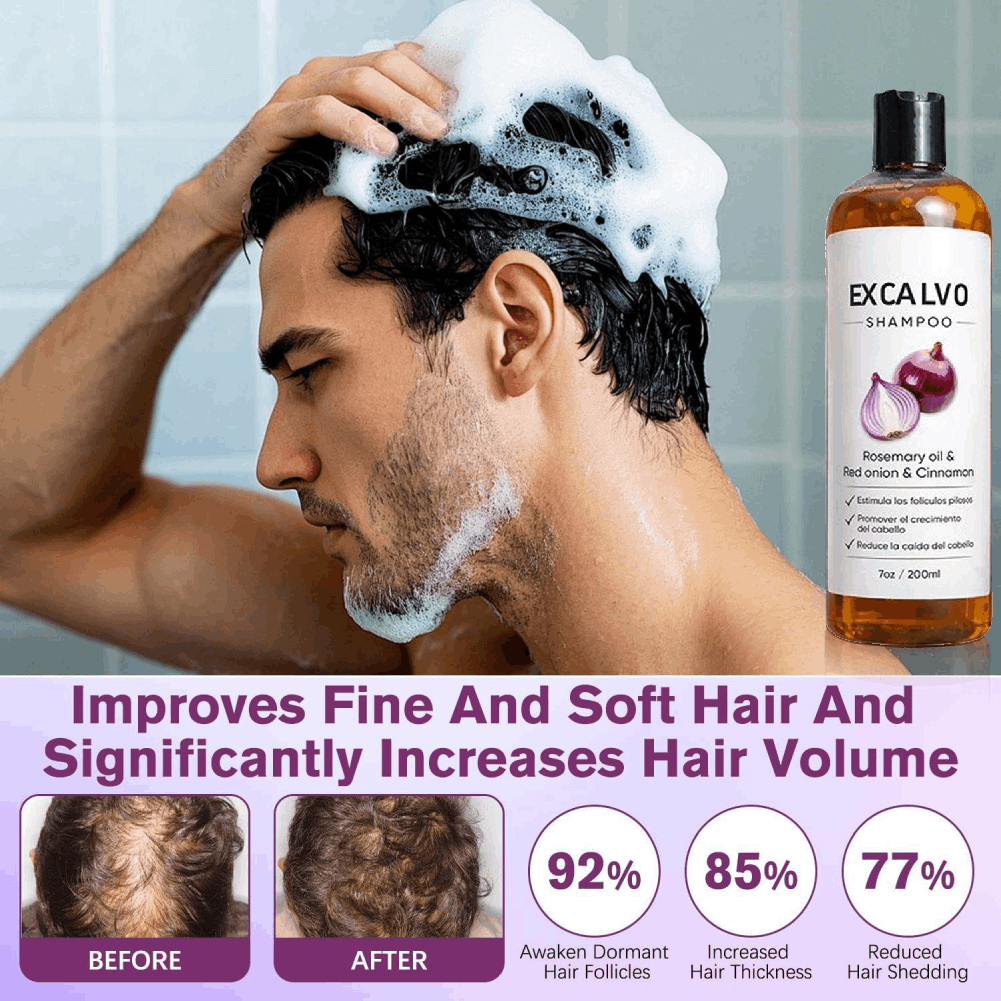 Szampon przeciw wypadaniu włos – Rosemary Hair Oil recenzja i cena