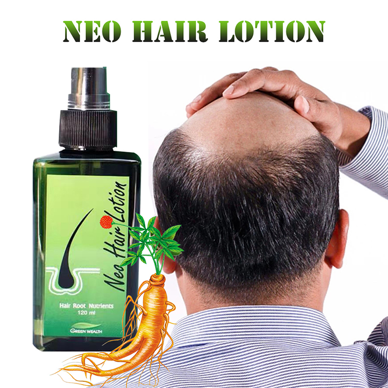Nowy Oryginalny Neo Hair Lotio – Hair Care Thailand recenzja i cena