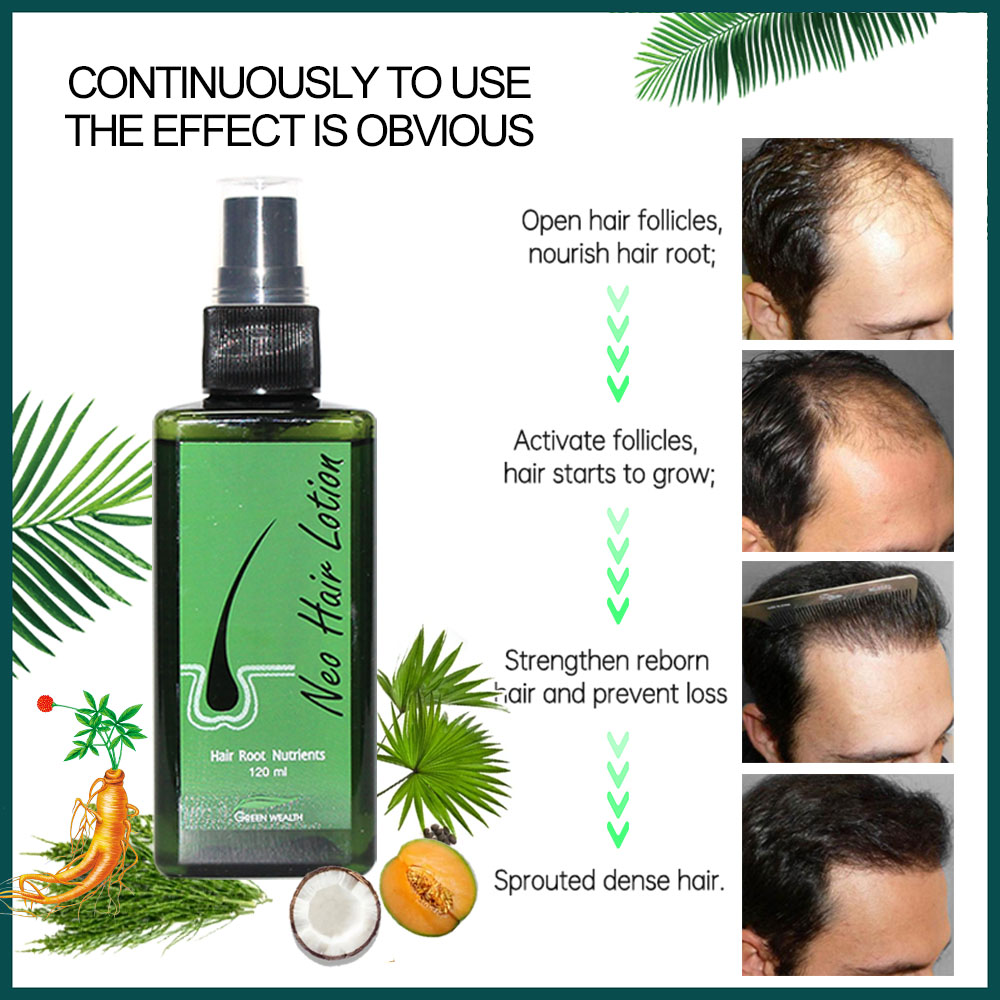 Oryginalny Neo Hair Lotion 120 – Hair Care Thailand recenzja i cena